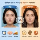 최윤정피부과의원 네이버블로그
