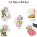 심장질환의 종착역 심부전 증상 및 원인과 치료 급성 심부전증 이미지