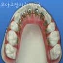 도담교정치과기공소 | 금천구 독산동 치과 모아교정치과기공소 위치 오는길 후기