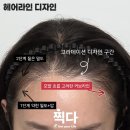 라인헤어 | 서울 여성 헤어라인 내돈내산 후기, 인터뷰 영상 공개