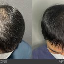 헤드샷스칼프본점 이미지