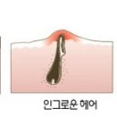 인헤어(in-hair) 이미지