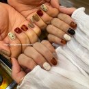 포스네일(4'S-NAIL)