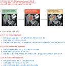 암세포, Tumour heterogeneity, Drug-tolerant persister cell 암치료 프로토콜을 위한 필수지식.. 이미지