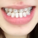 순천제일의원 이미지