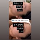 린 피부&체형 | [당산피부관리] 린에스테틱 웨딩관리 후기 | 사상체질과 얼굴윤곽, 이중턱까지 한 번에 케어해주는 린...