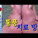 사암침, 사암침법 - 통풍 치료 방법 - 비과학적 양의학 140 이미지