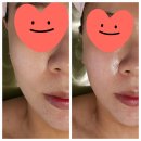 노원-상계-노원-(저)002009 | 노원피부관리 노원윤곽관리 상계역 아리아뷰티 후기