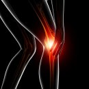 약수바른정형외과의원 이미지