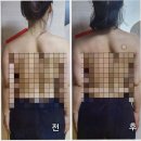 신안헬스케어 | 엔터핏 헬스&amp;PT&amp;요가&amp;줌바 본오점, 본오동 임산부PT 내돈내산