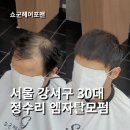 서울 강서구 정수리 엠자탈모펌 더 심해지기 전 예방이 중요합니다