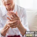 관절보궁