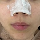 희메디칼 | 마곡 힐링과 피부관리를 같이 여드름관리 희아로움 후기