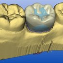 강남치과기공소 이미지