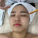 [해운대 에스테틱] 이끌뷰티에스테 모공피지쏙쏙케어+ 앰플부스터 mts케어