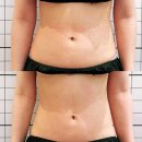 태크니끄 해운대 셀핏 프리미엄 | [해운대 피부 에스테틱 • 관리 추천] 태크니끄 해운대 셀핏 프리미엄