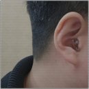 일산보청기센터 이미지