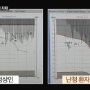 소리케어보청기 이미지