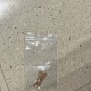 데이뷰의원 | [여의도 피부과] 데이뷰의원 여의도점 티타늄 리프팅 &amp; 쥬베룩 2cc 꿀조합 후기✨ 데이뷰의원 솔직 방문기