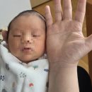 청담엠의원 | 제왕절개 수술 5일차 후기(청담마리산부인과)