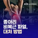 강동역정형외과 비복근 파열, 종아리 통증 대처 방법
