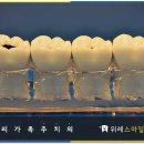 위례스마일치과 이미지
