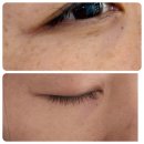 청아스킨앤바디 | 강서구색소제거 전문 Room110 스킨앤바디 후기｜색소관리 실제 경험