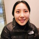 웃어야 웃을 일 | 거미스마일 보톡스 가격 &amp; 잇몸성형 후기, 10분 만에 오랑우탄 탈출