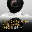 광남위생 | 가르마두피문신 잘하는 리게인프로젝트 대구본점 방문 후기 시술 과정과 효과 정보