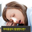 부비동암 증상은?<<군포이비인후과 이미지