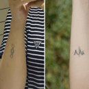 연세스타피부과의원 | [신촌 연세스타피부과] 타투 제거 1회차 후기 + 한달 후기!!