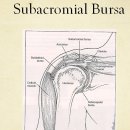 subacromial bursitis검사 Dawban’s test 이미지