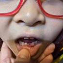 부흥사우나 | 유니, 발치, 열탕후기