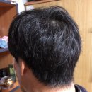 선 헤어필 | [닥터탑] 스칼프 헤어 볼륨 샴푸 / 탈모방지샴푸 리뷰 및 후기