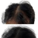 머리꽃 피우다 이미지