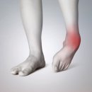 다나가정의원 | 용답동 정형외과 발목 인대 파열 회복과정과 효과적인 재활법