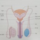 요도파열과 요도협착 증상및 수술방법과 발기부전 보상안내 이미지