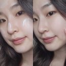 안세케어 이미지