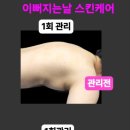 이뻐지는날스킨케어