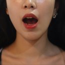 강남대로89길 15 | [강남 안면비대칭한의원] 안면비대칭 치료 15회 받으면 얼마나 효과가 있을까?