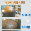 에코헤나디톡스 네이버블로그