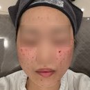 블리비의원 | 전주 블리비의원 후기/내돈내산/슈링크유니버스/리쥬란