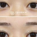 두땀