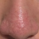 진성레이져 이미지