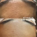 수디끌스킨