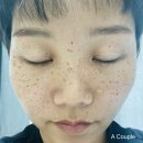 이지미의원 네이버블로그