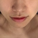 고봉로 | 올가드림뷰티 고봉로점 물광관리 두피관리 모낭충검사까지 후기
