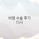 디시80 | 비염 수술 후기 디시, 후기 핵심 요약
