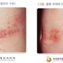 가산곧바로의원