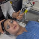 압구정 색소 치료 기미 레이저 피코토닝 피코트리플 피부과